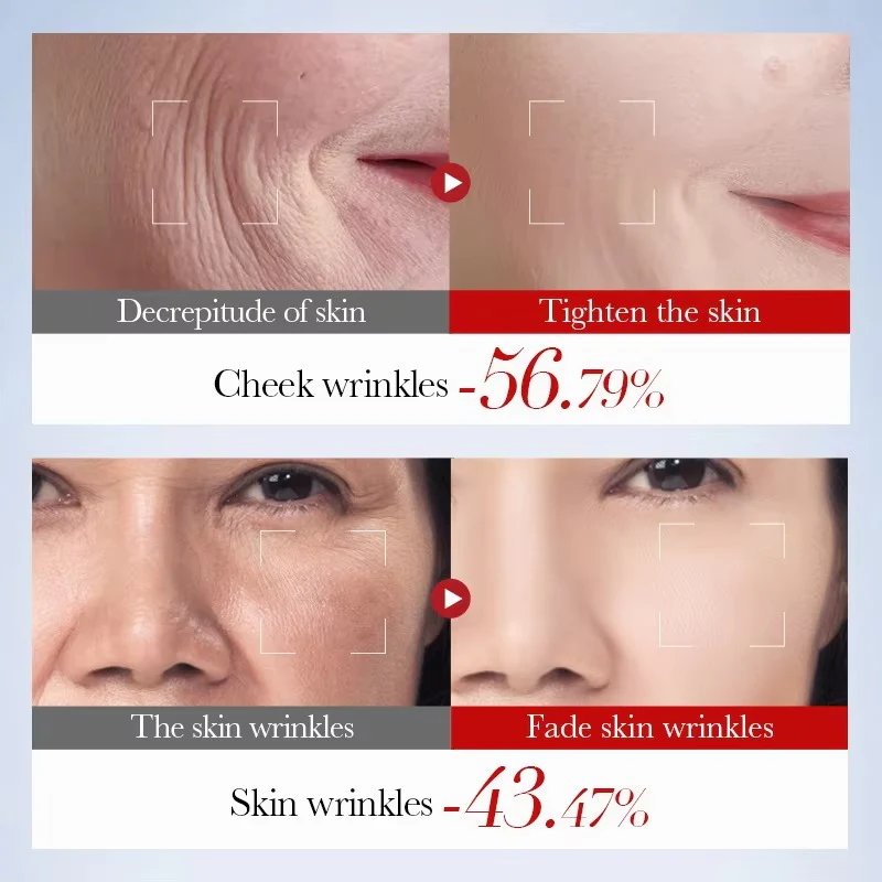 SADOER Snail Collagen Anti-Wrinkle Skincare Set - 5-Piece Firming & Moisturizing Kit - Image 5